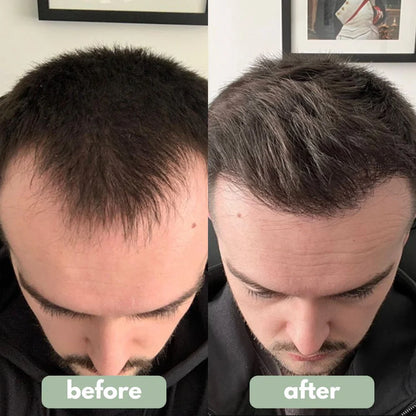 Reverse Hairserum
